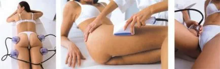 Hogyan lehet az anti-cellulit masszázs otthon