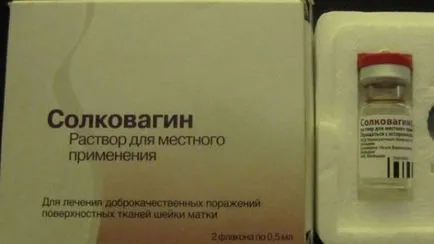 Hogyan kauterizálására méhnyak erózió módszerek, érzi a hatását, a szövődmények megelőzése