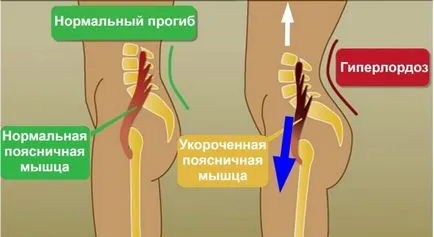 Hogyan lehet elkapni egy előre osztott és miért van rá (továbbviszi split) Hogyan lehet elkapni egy előre osztott és miért van rá