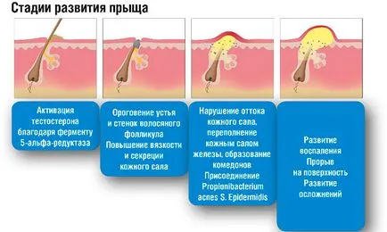 Hogyan lehet felgyorsítani az érési pattanások az arcon genny vagy anélkül genny (érés) Hogyan lehet felgyorsítani az érési pattanások az arcon genny vagy anélkül genny