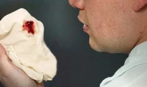 Köhögés a vér alapvető okainak