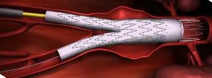Clinic innovatív sebészet - korszerű technológiák Érsebészeti (vaszkuláris) Clinic innovatív sebészet - korszerű technológiák Érsebészeti
