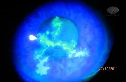 Keratitis, a tünetek, okok, kezelés keratitis