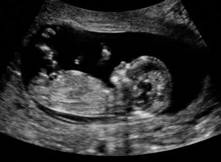 Amikor az ultrahang megmutatja terhesség - milyen nap késedelem menni (a) Amikor az ultrahang megmutatja terhesség - milyen nap késés menni