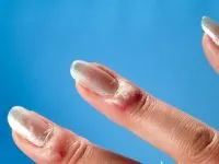 Bone a csuklón a külső okok, tünetek, diagnózis és kezelés módszereit (csukló) Bone a csuklón a külső okok, tünetek, diagnózis és kezelési módszerek