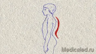 Kezelésére és megelőzésére csontbetegség (csont) Kezelésére és megelőzésére csontbetegségek