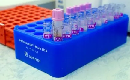 Kezelése allergiás bronchitis és annak megakadályozása