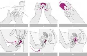 Menstruációs csésze fotó, utasítás és visszajelzés (feedback) Menstruációs csésze fotó, utasítás és visszajelzés