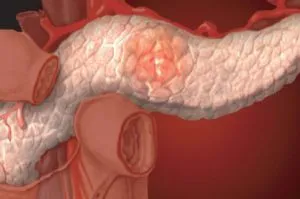 Metronidazol, melyek kijelölik (alkalmazás) pobochnyedeystviya tabletta ár (metronidazol) Metronidazol, melyek kijelölik (alkalmazás) pobochnyedeystviya tabletta ára
