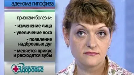 Microadenoma agyalapi okoz, tünetei és kezelések