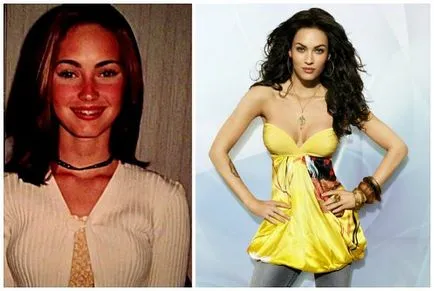 Megan fox előtt és után plasztikai sebészet fotók és videó