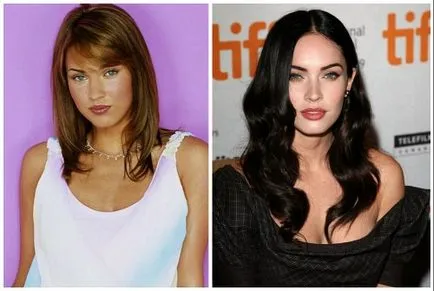 Megan fox előtt és után plasztikai sebészet fotók és videó