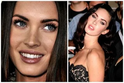 Megan fox előtt és után plasztikai sebészet fotók és videó