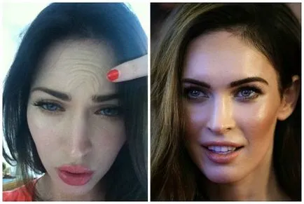 Megan fox előtt és után plasztikai sebészet fotók és videó