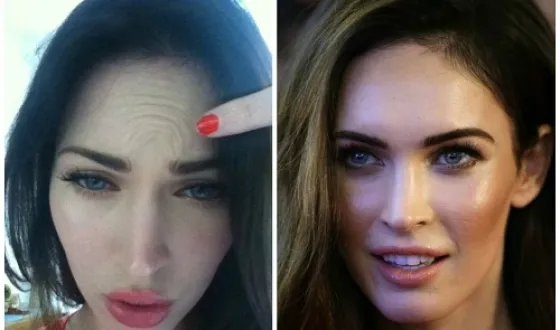 Megan fox előtt és után plasztikai sebészet fotók és videó