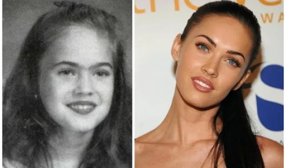 Megan fox előtt és után plasztikai sebészet fotók és videó