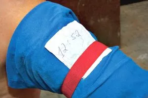 Overlay gumik törések
