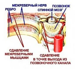 Neuralgia - okai, tünetei, tünetek és kezelés (tünetek) Neuralgia - okai, tünetei, tünetek és kezelés