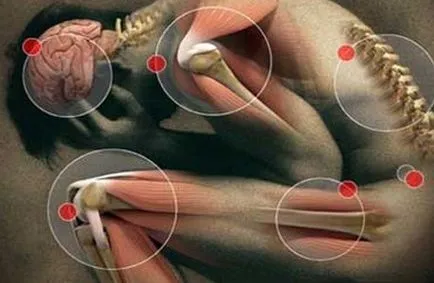 Neuralgia - okai, tünetei, tünetek és kezelés (trigeminus neuralgia ülőideg occipitalis bordaközi glossopharyngeus kezelés okoz tüneteket) Neuralgia - okai, tünetei, tünetek és kezelés