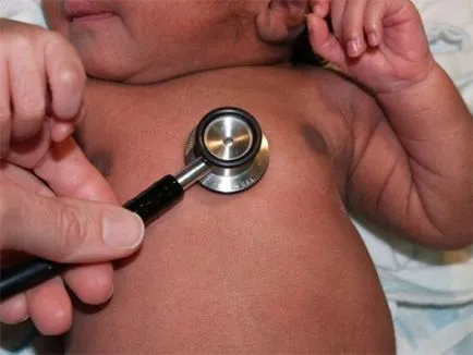 Nyitott foramen ovale, a szívében egy gyermek a csecsemőknél és újszülött lyuk, a szív (ovális) Nyitott foramen ovale, a szívében egy gyermek a csecsemőknél és újszülött lyuk, a szív