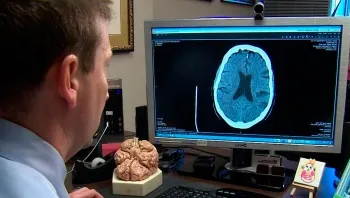 Ferde arcát szélütés miért törött mimika és hogyan kell kijavítani torzítás (ferdeség) Ferde arc szélütés miért törött arckifejezések és hogyan kell kijavítani torzulások