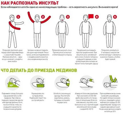 Az első tünetek a stroke a férfiak és nők, hogy mit kell tenni a stroke tüneteit (jelek a stroke tüneteinek első hírnöke közelgő nő) Az első tünetek a stroke a férfiak és nők, hogy mit kell tenni a jelei a stroke