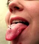 Nyelv piercing - két átszúrja a nyelvem, dísztárgyak, feldolgozása és hatása a defekt után (nyelv) Nyelv piercing - két átszúrja a nyelvem, dísztárgyak, feldolgozása és hatása a defekt után