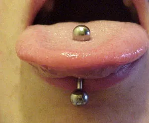 Nyelv piercing előnyei és hátrányai