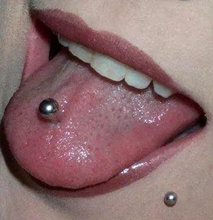 Nyelv piercing előnyei és hátrányai