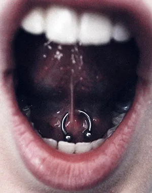 Nyelv piercing előnyei és hátrányai