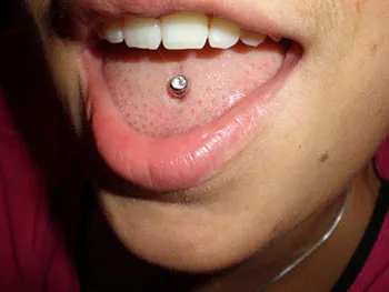 Nyelv piercing előnyei és hátrányai