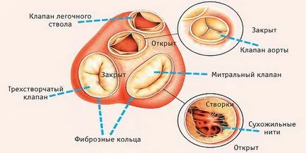 Szívbillentyű-betegség diagnosztizálása, kezelése és megelőzése