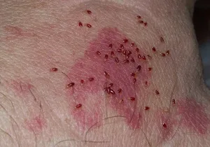 Poloska szeretnék megszabadulni a saját otthonában