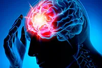 előfutárai stroke férfiak és a nők