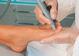 Előnyei lézeres kezelés benőtt köröm