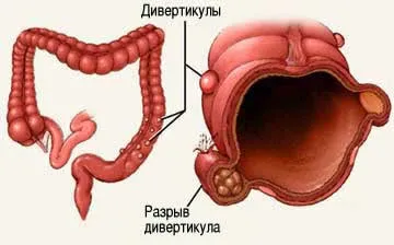 Az okok a fájdalom a köldök