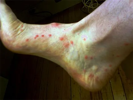Jumping rovarok a lakásban hogyan lehet megoldani a kis vérszívók