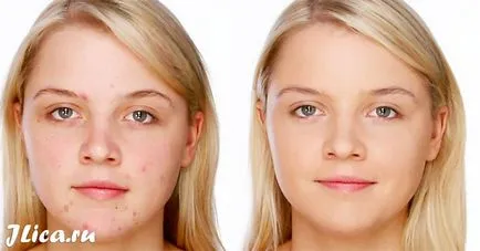 Probléma Skin Face 11 maszkok, eszközök és értékelés (megjegyzések) Probléma Skin Face 11 maszkok, szerszámok, és vélemények
