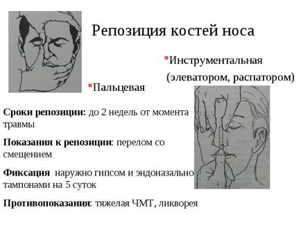 Helyezze orr törés sérülés után videók, fotók, hatásai