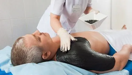 Szanatóriumi kezelés rheumatoid arthritis (spa) Szanatórium a reumatoid arthritis kezelésére