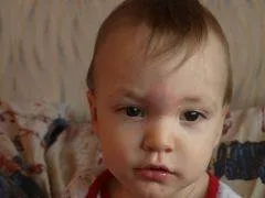 Bump a gyermek homlokára okai és hogyan kell kezelni - az életem (baby) Bump a gyermek homlokára okai és hogyan kell kezelni - az életem