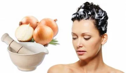 Peeling fejbőr miért erősen kifejtve a gyerek, mit kell tenni (sok) Peeling fejbőr miért erősen kifejtve a gyerek, mit kell tenni