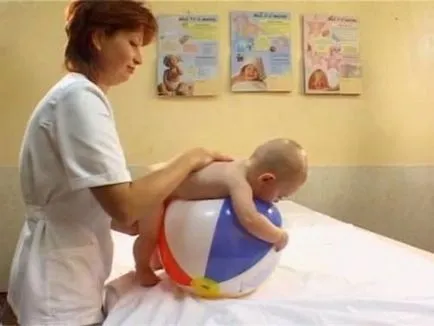 Szindróma motoros rendellenességek az újszülötteknél és a kezelés a tünetek (neonatális) Szindróma motoros rendellenességek az újszülöttek tünetei és kezelése