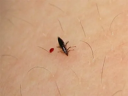 Eszközei bolhák a lakásban mit és hogyan kell hatékonyan kezelni a bolhák a házban