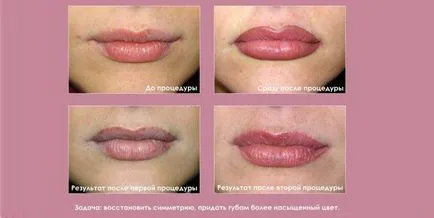 Lip Tattoo különböző technikák és színek, ár, fotó előtt és után mikropigmentirovaniya