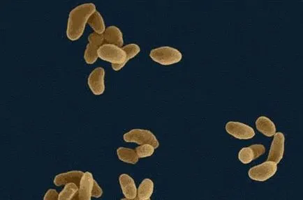 Tularemia mi ez, és milyen veszélyes (mikroorganizmusok hit első) Tularemia mi ez, és milyen veszélyes
