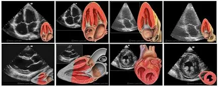 Ultrahang vizsgálat a jelzések diagnosztikai vizsgálatok típusú ultrahang diagnosztika