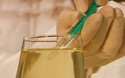 Vizelet vizelet alkalmazása az orvostudományban, a test tisztító egészségügyi