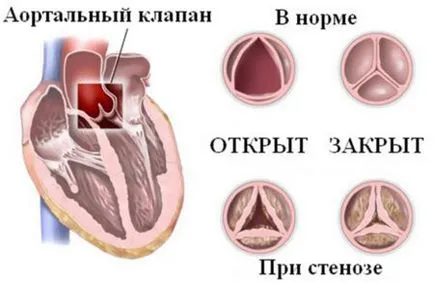 szívultrahang