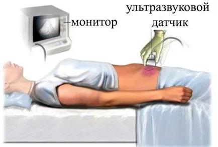 Kismedencei UH transzvaginális, hasi, előkészítése, ár (kicsi) Kismedencei UH transzvaginális, hasi, előkészítése, ár
